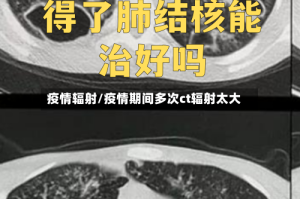 疫情辐射/疫情期间多次ct辐射太大