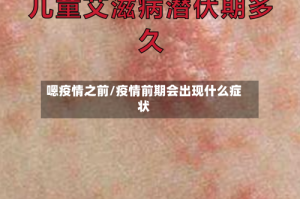 嗯疫情之前/疫情前期会出现什么症状
