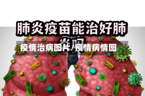 疫情治病图片/疫情病情图