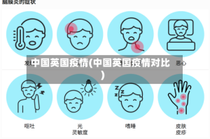 中国英国疫情(中国英国疫情对比)