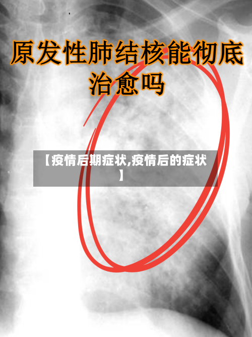 【疫情后期症状,疫情后的症状】-第1张图片