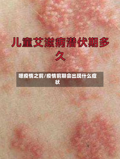 嗯疫情之前/疫情前期会出现什么症状-第1张图片