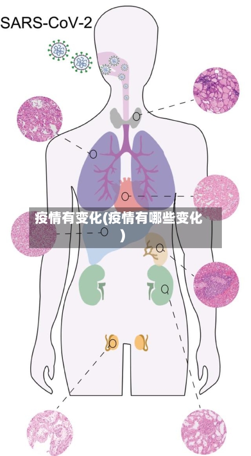 疫情有变化(疫情有哪些变化)-第1张图片