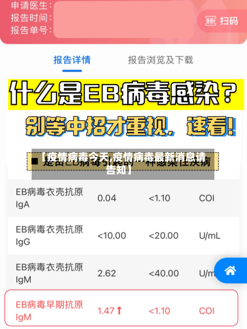 【疫情病毒今天,疫情病毒最新消息请告知】-第3张图片