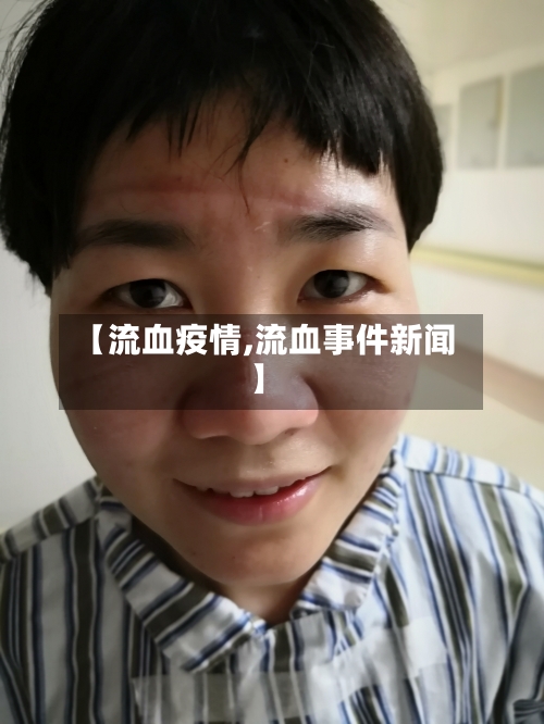 【流血疫情,流血事件新闻】-第3张图片