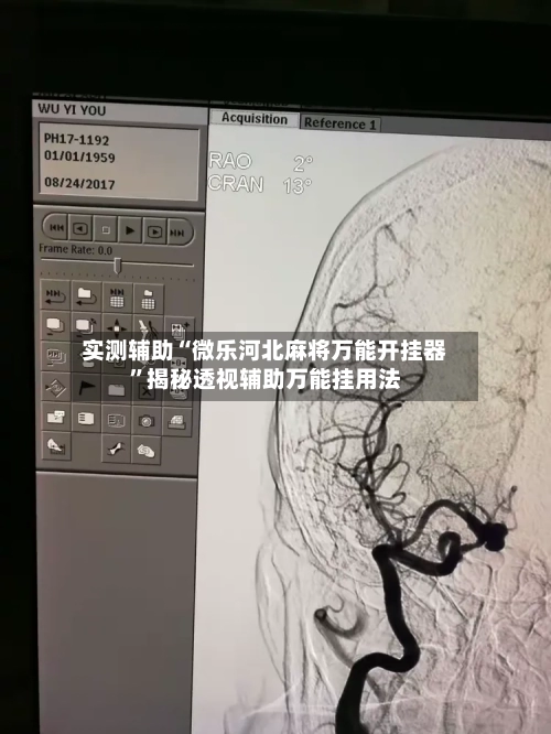实测辅助“微乐河北麻将万能开挂器	”揭秘透视辅助万能挂用法-第1张图片