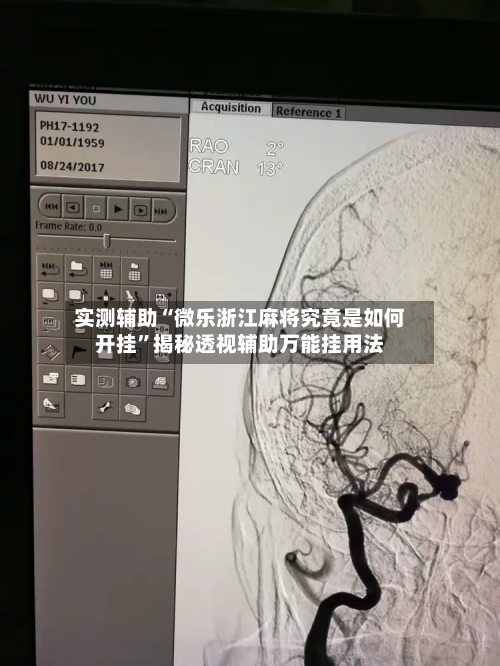 实测辅助“微乐浙江麻将究竟是如何开挂	”揭秘透视辅助万能挂用法-第2张图片